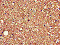 Immunofluorescent analysis of HepG2 cells using CAC14888 at dilution of 1:100 and Alexa Fluor 488-congugated AffiniPure Goat Anti-Rabbit IgG(H+L)