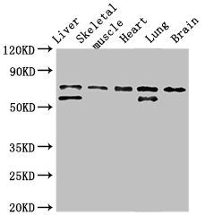 BIRC2 Polyclonal Antibody - image 2