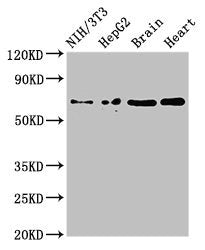 Immunohistochemistry of paraffin-embedded human small intestine tissue using CAC14904 at dilution of 1:100