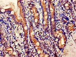 Immunofluorescent analysis of A549 cells using CAC14904 at dilution of 1:100 and Alexa Fluor 488-congugated AffiniPure Goat Anti-Rabbit IgG(H+L)