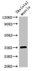 Immunohistochemistry of paraffin-embedded human testis tissue using CAC14907 at dilution of 1:100