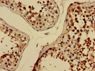 Immunohistochemistry of paraffin-embedded human adrenal gland tissue using CAC14907 at dilution of 1:100