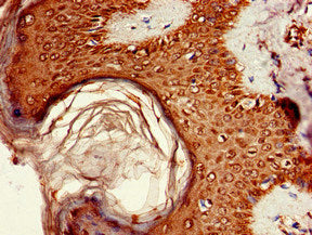 Immunohistochemistry of paraffin-embedded human lung tissue using CAC14910 at dilution of 1:100