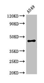Immunofluorescent analysis of Hela cells using CAC14921 at dilution of 1:100 and Alexa Fluor 488-congugated AffiniPure Goat Anti-Rabbit IgG(H+L)
