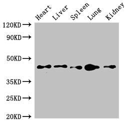 Immunohistochemistry of paraffin-embedded human lung tissue using CAC14924 at dilution of 1:100