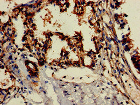 Immunohistochemistry of paraffin-embedded human lymph node tissue using CAC14924 at dilution of 1:100
