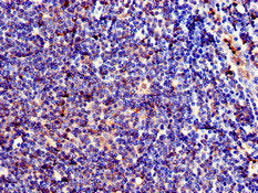 Immunofluorescent analysis of HepG2 cells using CAC14924 at dilution of 1:100 and Alexa Fluor 488-congugated AffiniPure Goat Anti-Rabbit IgG(H+L)