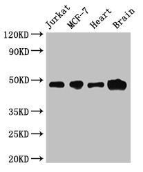 Immunofluorescent analysis of HepG2 cells using CAC14939 at dilution of 1:100 and Alexa Fluor 488-congugated AffiniPure Goat Anti-Rabbit IgG(H+L)