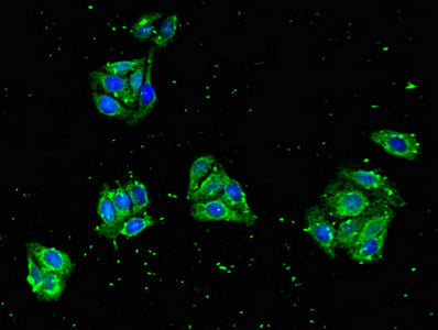 CBLL2 Polyclonal Antibody - image 3