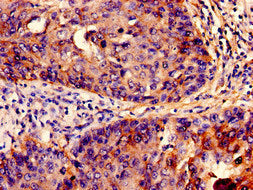 Immunoprecipitating IFITM3 in HepG2 whole cell lysate, Lane 1: Rabbit control IgG instead of CAC14942 in HepG2 whole cell lysate. For western blotting, a HRP-conjugated Protein G antibody was used as the secondary antibody (1/2000), Lane 2: CAC14942 (6ug) + HepG2 whole cell lysate (500ug), Lane 3: HepG2 whole cell lysate (20ug)