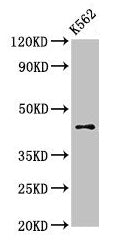 Immunohistochemistry of paraffin-embedded human kidney tissue using CAC14950 at dilution of 1:100