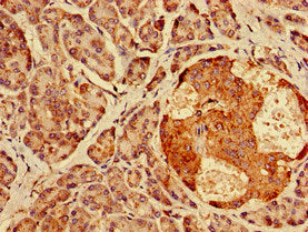 AGPAT3 Polyclonal Antibody - image 4