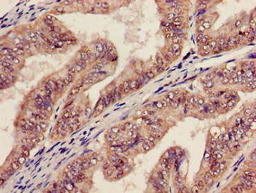 AGPAT5 Polyclonal Antibody - image 4