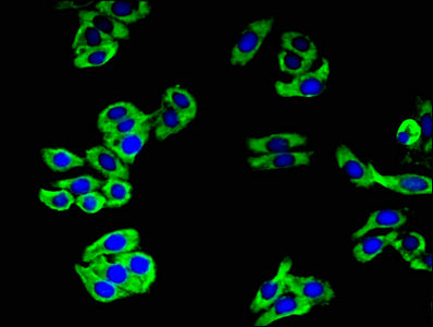 Immunoprecipitating CAMLG in HEK293 whole cell lysate, Lane 1: Rabbit control IgG (1ug) instead of CAC14954 in HEK293 whole cell lysate. For western blotting, a HRP-conjugated Protein G antibody was used as the secondary antibody (1/2000), Lane 2: CAC14954 (8ug) + HEK293 whole cell lysate (500ug), Lane 3: HEK293 whole cell lysate (10ug)