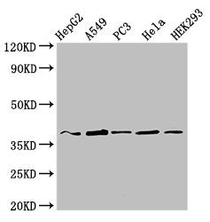 Immunofluorescent analysis of A549 cells using CAC14956 at dilution of 1:100 and Alexa Fluor 488-congugated AffiniPure Goat Anti-Rabbit IgG(H+L)
