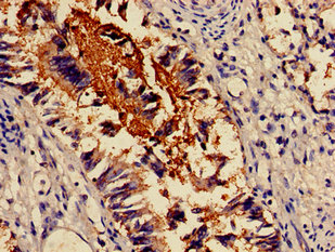 ACTN4 Polyclonal Antibody - image 3