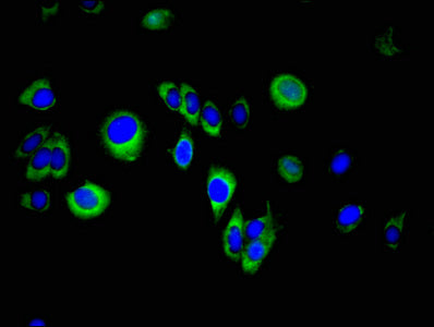 SPINT2 Polyclonal Antibody - image 3