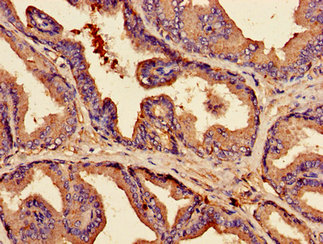 CLDN3 Polyclonal Antibody - image 3