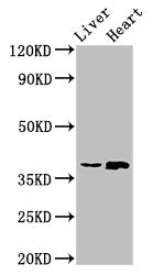 Immunohistochemistry of paraffin-embedded human liver cancer using CAC14975 at dilution of 1:100