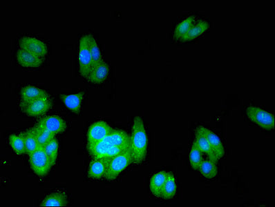 ACMSD Polyclonal Antibody - image 5