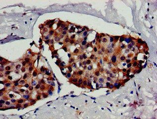 Immunofluorescent analysis of Hela cells using CAC14986 at dilution of 1:100 and Alexa Fluor 488-congugated AffiniPure Goat Anti-Rabbit IgG(H+L)