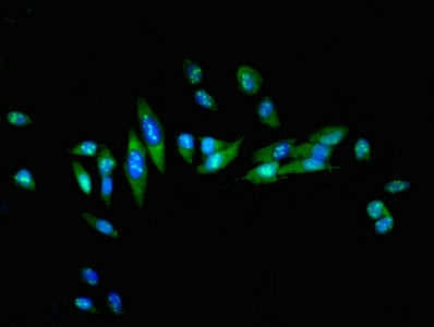 HSF1 Polyclonal Antibody - image 4