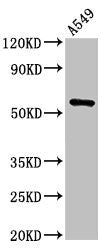 Immunohistochemistry of paraffin-embedded human lung tissue using CAC14993 at dilution of 1:100