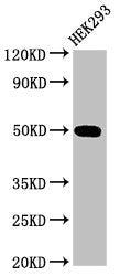 Immunohistochemistry of paraffin-embedded human cervical cancer using CAC15009 at dilution of 1:100
