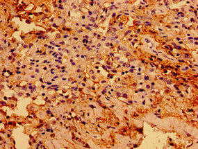 TGFB1I1 Polyclonal Antibody - image 3
