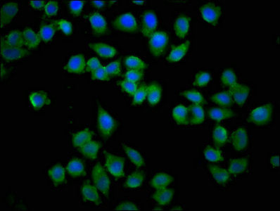 KY Polyclonal Antibody - image 4