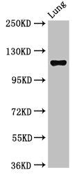 IHC image of CAC15017 diluted at 1:400 and staining in paraffin-embedded human lung cancer performed on a Leica BondTM system. After dewaxing and hydration, antigen retrieval was mediated by high pressure in a citrate buffer (pH 6.0). Section was blocked with 10% normal goat serum 30min at RT. Then primary antibody (1% BSA) was incubated at 4°C overnight. The primary is detected by a biotinylated secondary antibody and visualized using an HRP conjugated SP system.