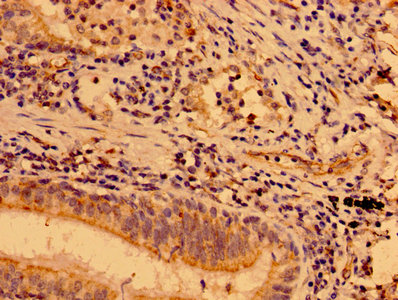 Immunofluorescence staining of A549 cells with CAC15017 at 1:133, counter-stained with DAPI. The cells were fixed in 4% formaldehyde, permeabilized using 0.2% Triton X-100 and blocked in 10% normal Goat Serum. The cells were then incubated with the antibody overnight at 4°C. The secondary antibody was Alexa Fluor 488-congugated AffiniPure Goat Anti-Rabbit IgG(H+L).