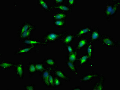 Western Blot, Positive WB detected in: NIH/3T3 whole cell lysate, All lanes: RELB antibody at 3ug/ml, Secondary, Goat polyclonal to rabbit IgG at 1/50000 dilution, Predicted band size: 63 kDa, Observed band size: 63 kDa