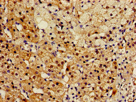 Immunofluorescent analysis of HepG2 cells using CAC15026 at dilution of 1:100 and Alexa Fluor 488-congugated AffiniPure Goat Anti-Rabbit IgG(H+L)