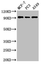 AMPD1 Polyclonal Antibody - image 2
