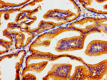 Immunofluorescent analysis of HepG2 cells using CAC15037 at dilution of 1:100 and Alexa Fluor 488-congugated AffiniPure Goat Anti-Rabbit IgG(H+L)