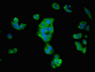 ATP1B1 Polyclonal Antibody - image 5