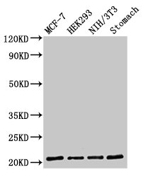Immunofluorescent analysis of HepG2 cells using CAC15040 at dilution of 1:100 and Alexa Fluor 488-congugated AffiniPure Goat Anti-Rabbit IgG(H+L)