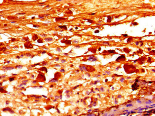 Immunofluorescence staining of U251 cells with CAC15045 at 1:200, counter-stained with DAPI. The cells were fixed in 4% formaldehyde, permeabilized using 0.2% Triton X-100 and blocked in 10% normal Goat Serum. The cells were then incubated with the antibody overnight at 4°C. The secondary antibody was Alexa Fluor 488-congugated AffiniPure Goat Anti-Rabbit IgG(H+L).