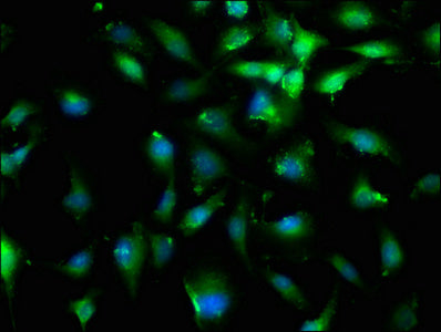 FBN1 Polyclonal Antibody - image 3