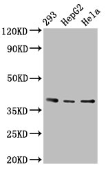 Immunohistochemistry of paraffin-embedded human testis tissue using CAC15057 at dilution of 1:100