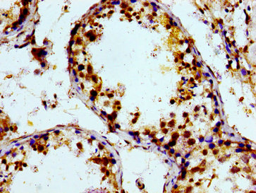 Immunohistochemistry of paraffin-embedded human kidney tissue using CAC15057 at dilution of 1:100