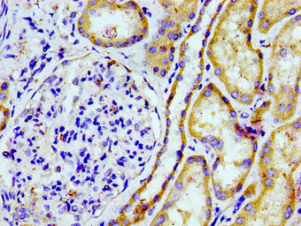 Immunofluorescence staining of A549 cells with CAC15057 at 1:166, counter-stained with DAPI. The cells were fixed in 4% formaldehyde, permeabilized using 0.2% Triton X-100 and blocked in 10% normal Goat Serum. The cells were then incubated with the antibody overnight at 4°C. The secondary antibody was Alexa Fluor 488-congugated AffiniPure Goat Anti-Rabbit IgG(H+L).