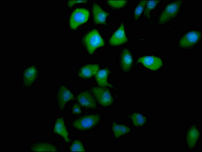 PTGR2 Polyclonal Antibody - image 5