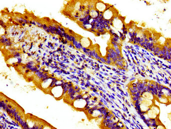 Immunofluorescent analysis of A549 cells using CAC15066 at dilution of 1:100 and Alexa Fluor 488-congugated AffiniPure Goat Anti-Rabbit IgG(H+L)