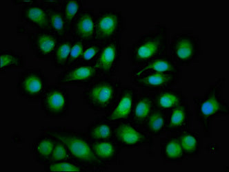 TOB1 Polyclonal Antibody - image 4