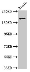 Immunofluorescent analysis of HepG2 cells using CAC15072 at dilution of 1:100 and Alexa Fluor 488-congugated AffiniPure Goat Anti-Rabbit IgG(H+L)