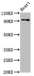 Immunohistochemistry of paraffin-embedded human brain tissue using CAC15074 at dilution of 1:100
