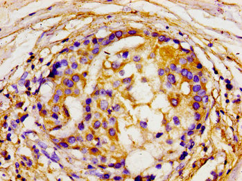Immunofluorescence staining of HepG2 cells with CAC15074 at 1:233, counter-stained with DAPI. The cells were fixed in 4% formaldehyde, permeabilized using 0.2% Triton X-100 and blocked in 10% normal Goat Serum. The cells were then incubated with the antibody overnight at 4°C. The secondary antibody was Alexa Fluor 488-congugated AffiniPure Goat Anti-Rabbit IgG(H+L).
