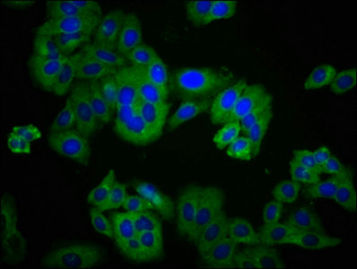 DLG2 Polyclonal Antibody - image 5